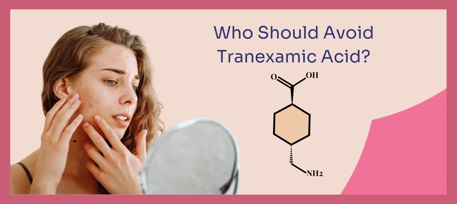 网红“氨甲环酸”被批准用于色斑治疗了吗？